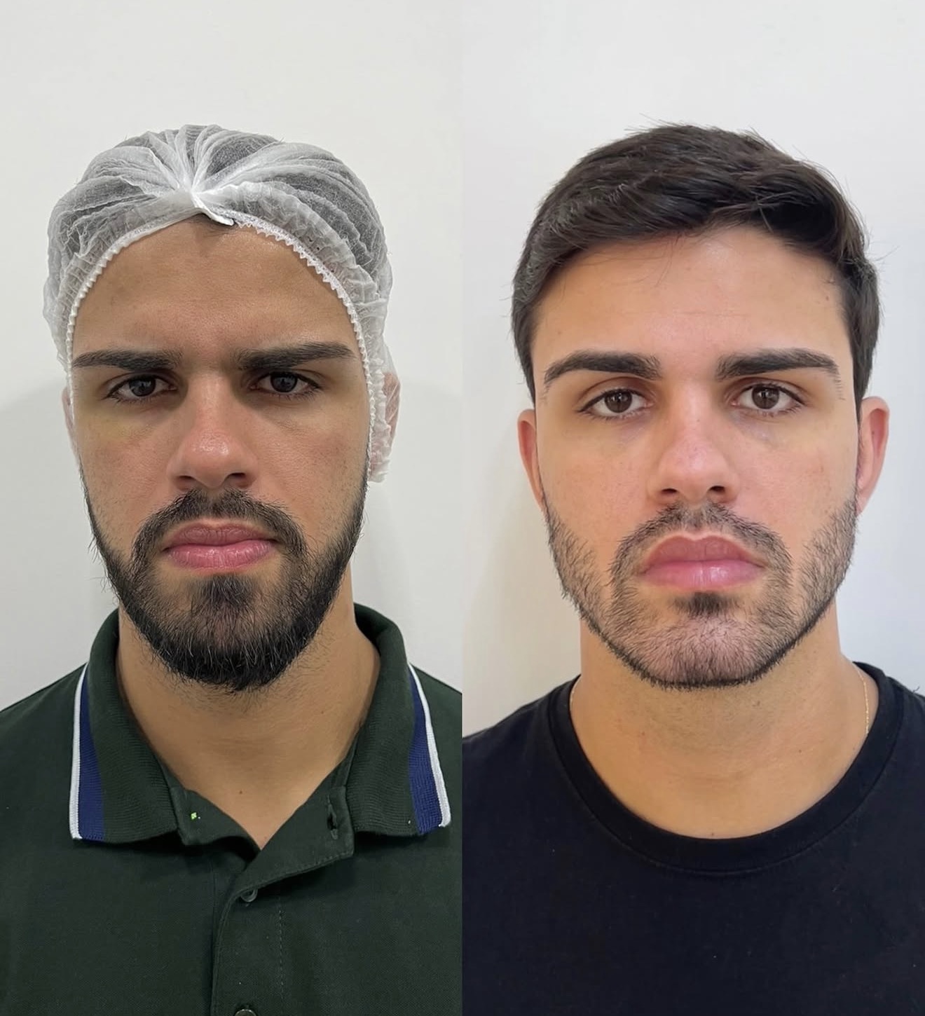 Harmonia e naturalidade para homens