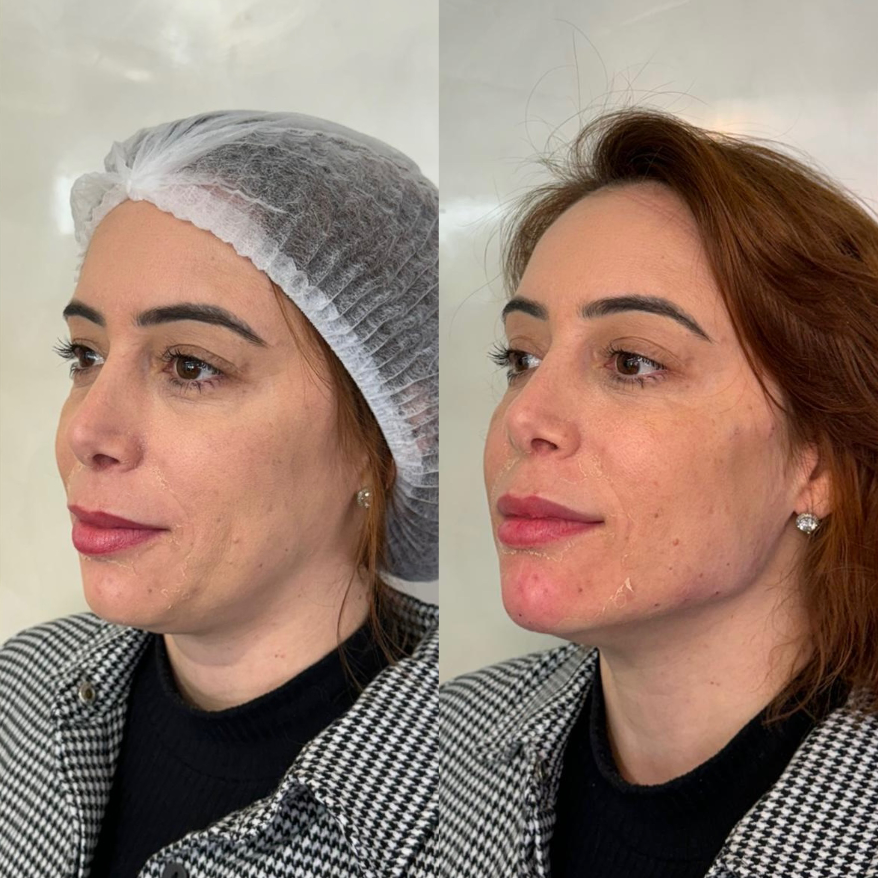 Harmonia do perfil
